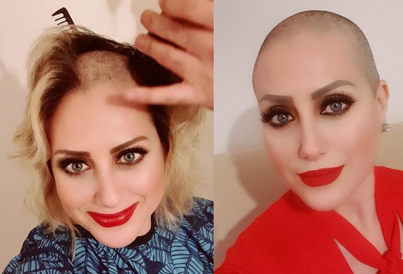 Kadına Şiddete Hayır Dedi Saçlarını Kazıttı!
